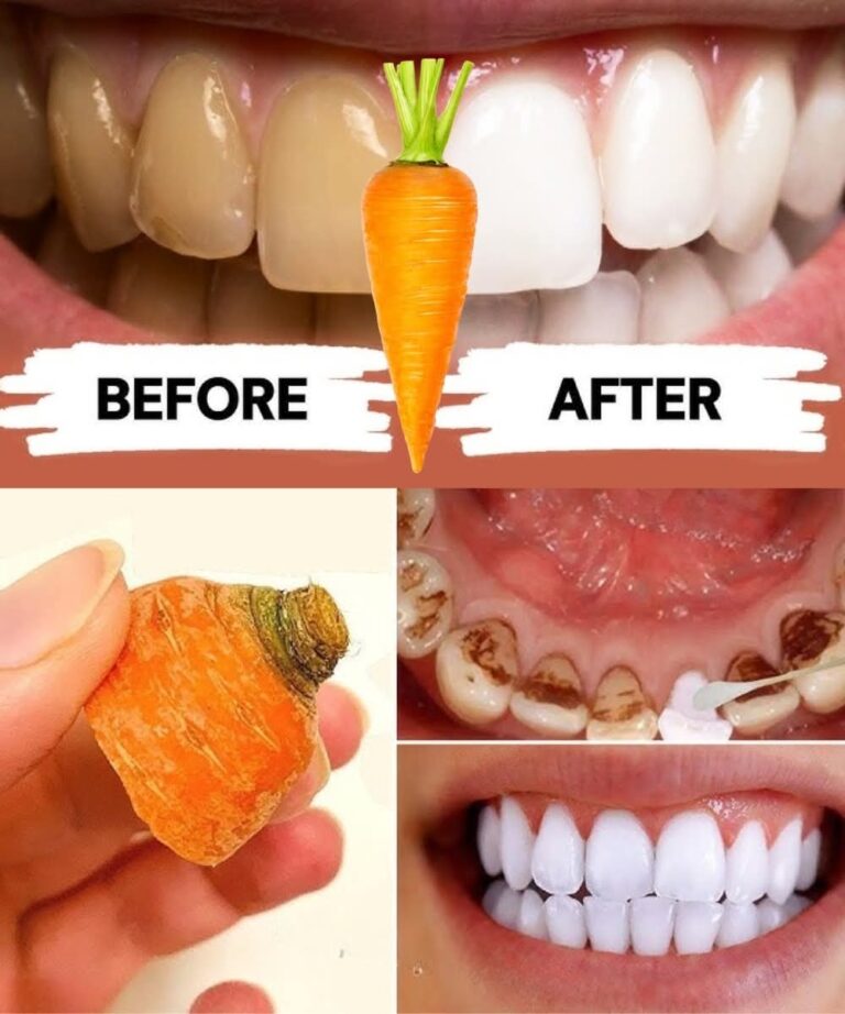 Home Teeth Whitening: Get Whiter Teeth in Just 2 Minutes!