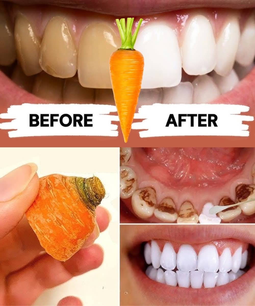Home Teeth Whitening: Get Whiter Teeth in Just 2 Minutes!