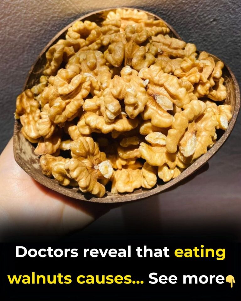 Proven Health Benefits of Walnuts, How Many to Eat, and More (Science Based)