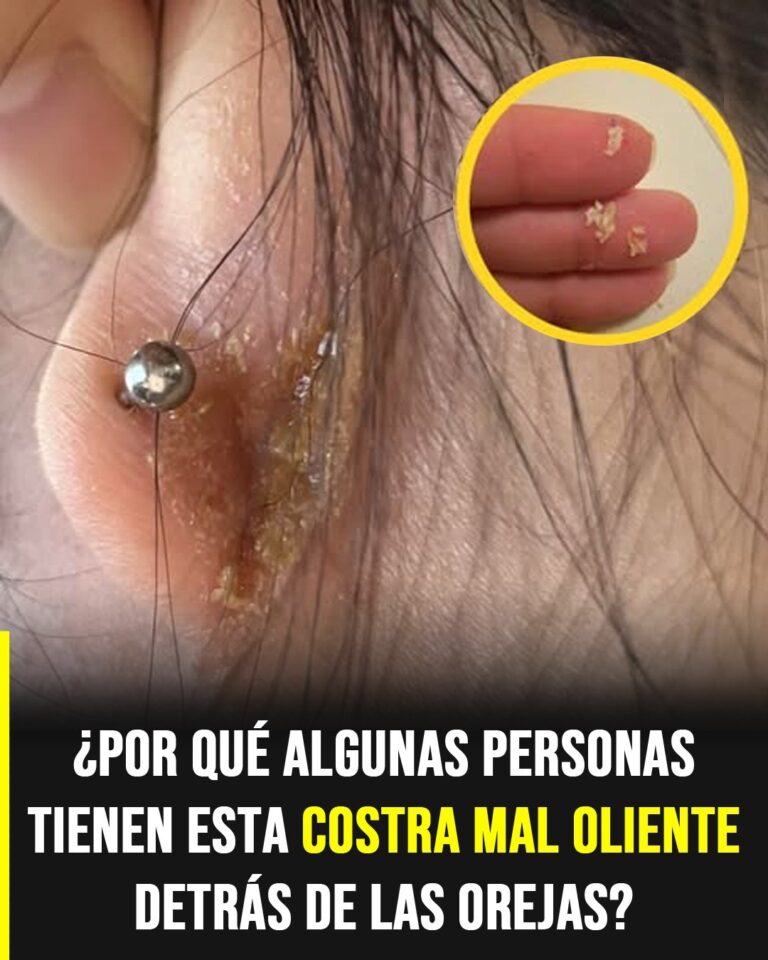 Costras con mal olor detrás de las orejas: causas reales y cómo identificar el problema a tiempo