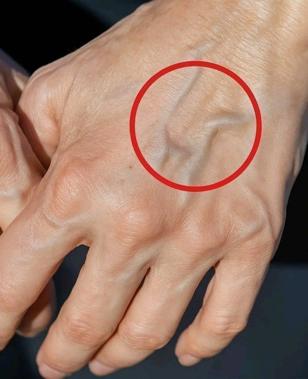 If you have visible veins, it means you are…
